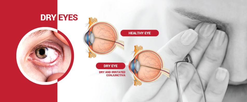 astaxanthin for eyes